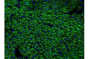 Image no. 3 for anti-Cardiotin antibody (ABIN335361) (Cardiotin Antikörper)