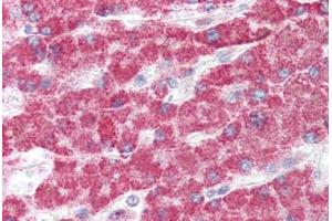 Human Liver (formalin-fixed, paraffin-embedded) stained with GCLC antibody ABIN337056 at 5 ug/ml followed by biotinylated goat anti-rabbit IgG secondary antibody ABIN481713, alkaline phosphatase-streptavidin and chromogen. (GCLC Antikörper  (AA 295-313))