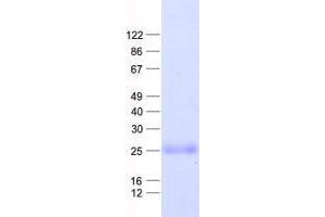 Validation with Western Blot (Transmembrane Protein 18 (TMM18) protein (His tag))