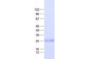 Transmembrane Protein 18 (TMM18) protein (His tag)