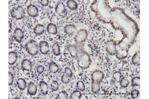 Immunoperoxidase of monoclonal antibody to ROD1 on formalin-fixed paraffin-embedded human small Intestine. (PTBP3 Antikörper  (AA 16-114))