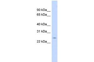 WB Suggested Anti-CRP Antibody Titration:  0. (CRP Antikörper  (N-Term))