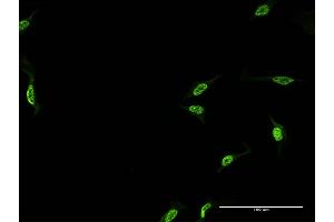Immunofluorescence of monoclonal antibody to CPSF6 on HeLa cell. (CPSF6 Antikörper  (AA 37-136))