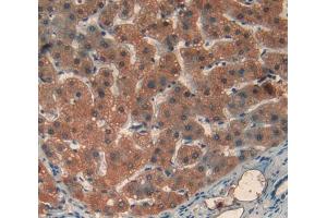 Used in DAB staining on fromalin fixed paraffin- embedded liver tissue (Transferrin Receptor 2 Antikörper  (AA 493-785))