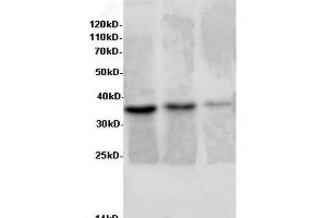 Western Blot analysis of Rat liver, Rat lung tissue and Jurkat cells using AIMP2 Polyclonal Antibody at dilution of 1:600 (AIMP2 Antikörper)