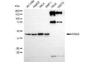 Western blotting analysis using PREB antibody (ABIN7799913). (Rekombinanter PREB Antikörper)
