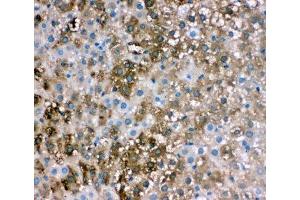IHC-P: FABP1 antibody testing of rat liver tissue (FABP1 (liver) Antikörper  (N-Term))