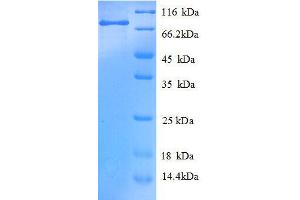 Keratin 8 (KRT8) (AA 2-483), (full length) protein (GST tag) (KRT8 Protein (AA 2-483, full length) (GST tag))