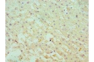 Immunohistochemistry of paraffin-embedded human liver tissue using ABIN7166366 at dilution of 1:100 (SERPINA1 Antikörper  (AA 165-444))