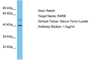 Host: Rabbit Target Name: RARB Sample Type: Uterus Tumor lysates Antibody Dilution: 1. (Retinoic Acid Receptor beta Antikörper  (N-Term))
