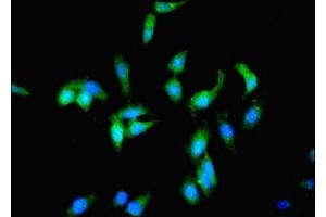 Immunofluorescent analysis of Hela cells using ABIN7163258 at dilution of 1:100 and Alexa Fluor 488-congugated AffiniPure Goat Anti-Rabbit IgG(H+L) (PCK1 Antikörper  (AA 1-622))