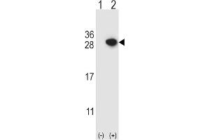 Western Blotting (WB) image for anti-rho GDP Dissociation Inhibitor (GDI) alpha (ARHGDIA) antibody (ABIN3001701)