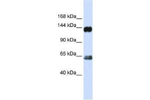 RAPGEF1 antibody used at 1 ug/ml to detect target protein. (GRF2 Antikörper)