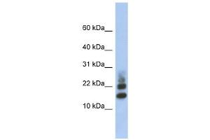 RPS15A antibody used at 1 ug/ml to detect target protein. (RPS15A Antikörper  (Middle Region))