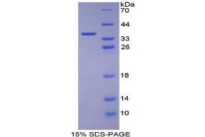 SDS-PAGE analysis of Mouse Keratin 1 Protein. (Cytokeratin 1 Protein)