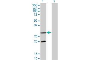 Western Blot analysis of DIABLO expression in transfected 293T cell line by DIABLO monoclonal antibody (M02A), clone 4F9. (DIABLO Antikörper  (AA 119-218))
