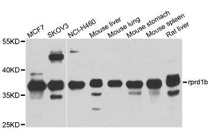 Western blot analysis of extracts of various cell lines, using rprd1b antibody (ABIN4905047) at 1:1000 dilution. (RPRD1B Antikörper)