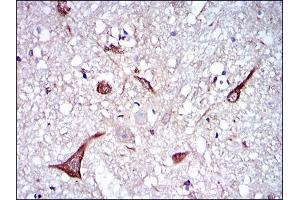 Immunohistochemical analysis of paraffin-embedded brain tissues using NEFL mouse mAb with DAB staining. (NEFL Antikörper)