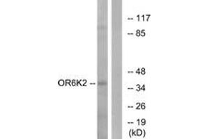 Western blot analysis of extracts from HeLa cells, using OR6K2 Antibody. (OR6K2 Antikörper  (AA 271-320))