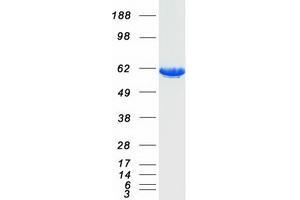 Western Blotting (WB) image for Pyruvate Kinase, Liver and RBC (PKLR) (Transcript Variant 1) protein (Myc-DYKDDDDK Tag) (ABIN2729045)