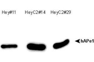 Image no. 1 for anti-DNA Repair Protein Apurinic Endonuclease antibody (ABIN5693483) (DNA Repair Protein Apurinic Endonuclease Antikörper)