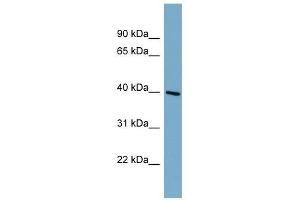 ST8SIA6 antibody used at 1 ug/ml to detect target protein. (ST8SIA6 Antikörper  (Middle Region))