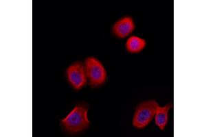 ABIN6258544 and ABIN6274949 staining Hela by IF/ICC. (CLIP3 Antikörper  (Internal Region))