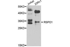 Western blot analysis of extract of various cells, using RSPO1 antibody. (RSPO1 Antikörper)
