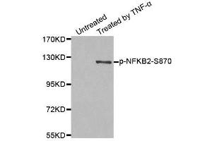 Western blot analysis of extract from MDA-MB-435 cells, using Phospho-NFKB2-S870 antibody (ABIN2988217). (NFKB2 Antikörper  (pSer870))