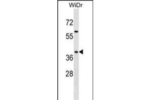 SY Antibody (C-term) 7291b western blot analysis in WiDr cell line lysates (35 μg/lane). (SYAP1 Antikörper  (C-Term))