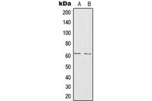 Western blot analysis of IL-20RA expression in A375 (A), MCF7 (B) whole cell lysates. (IL20RA Antikörper  (Center))