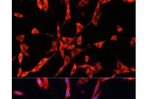 Immunofluorescence analysis of NIH/3T3 cells using GARS Polyclonal Antibody at dilution of 1:100. (GARS Antikörper)