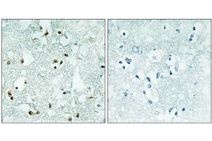 Immunohistochemistry analysis of paraffin-embedded human brain tissue, using ELAC2 antibody. (ELAC2 Antikörper  (Internal Region))