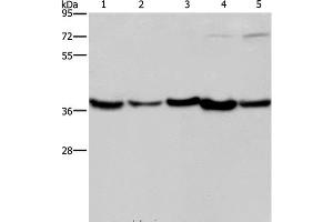 Western Blot analysis of Human fetal liver, Mouse skeletal muscle and heart tissue, Hela and Jurkat cell using DNAJB4 Polyclonal Antibody at dilution of 1:200 (DNAJB4 Antikörper)