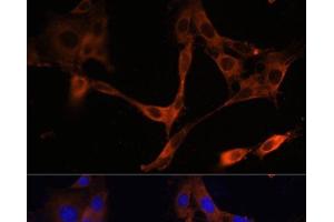 Immunofluorescence analysis of NIH/3T3 cells using HMGCR Polyclonal Antibody at dilution of 1:100. (HMGCR Antikörper)