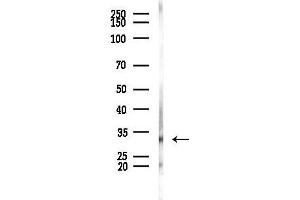 anti-Ring Finger Protein 166 (RNF166) antibody