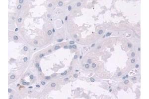Immunohistochemistry (IHC) image for anti-NEL-Like 2 (Chicken) (NELL2) (AA 64-331) antibody (ABIN7430120)