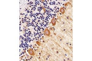 Immunohistochemistry (Paraffin-embedded Sections) (IHC (p)) image for anti-Palmitoyl-Protein Thioesterase 1 (PPT1) (AA 1-306) antibody (ABIN1944801)