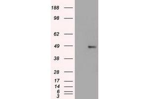 HEK293T cells were transfected with the pCMV6-ENTRY control (Left lane) or pCMV6-ENTRY FOXA1 (Right lane) cDNA for 48 hrs and lysed. (FOXA1 Antikörper  (AA 1-473))