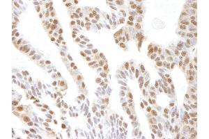 Immunohistochemistry (IHC) image for anti-Valosin Containing Protein (VCP) (C-Term) antibody (ABIN7448858)