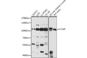 Western blot analysis of extracts of various cell lines, using COMP antibody (ABIN6127649, ABIN6138863, ABIN6138865 and ABIN6218152) at 1:1000 dilution. (COMP Antikörper  (AA 20-160))