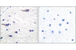 Immunohistochemistry analysis of paraffin-embedded human brain tissue, using PDGF Receptor beta (Ab-751) Antibody.