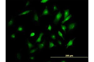 Immunofluorescence of purified MaxPab antibody to BST2 on HeLa cell.