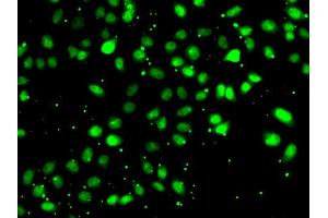 Immunofluorescence analysis of HeLa cell using NUDT2 antibody. (NUDT2 Antikörper)