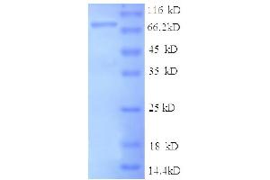 SDS-PAGE (SDS) image for Intercellular Adhesion Molecule 1 (ICAM1) (AA 28-480), (partial) protein (GST tag) (ABIN1047208)