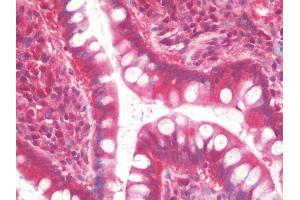 Anti-TCL / RHOJ antibody IHC staining of human small intestine. (RHOJ Antikörper)