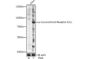 Western blot analysis of extracts of HeLa cells, using Phospho-Glucocorticoid Receptor-S211 antibody (ABIN6135269, ABIN6136160, ABIN6136161 and ABIN6225653) at 1:2000 dilution. (Glucocorticoid Receptor Antikörper  (pSer211))