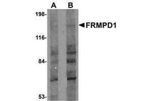 FRMPD1 抗体  (C-Term)