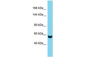 Western Blotting (WB) image for anti-Tensin 3 (TNS3) (C-Term) antibody (ABIN2790595)