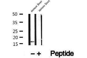 Western blot analysis of extracts of mouse liver tissue, using PRX5 antibody. (Peroxiredoxin 5 Antikörper  (C-Term))